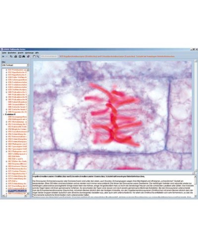 Wonder of the Plant Cell, Interactive CD-ROM